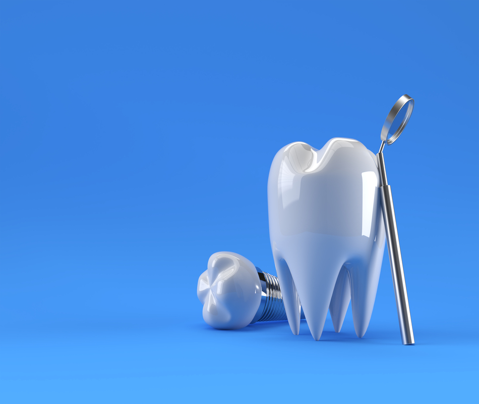 Dental Implants surgery concept 3D Rendering.